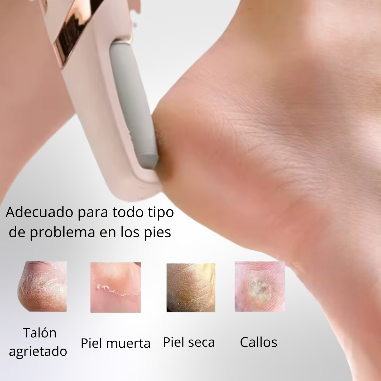 Removedor de callos profesional en casa